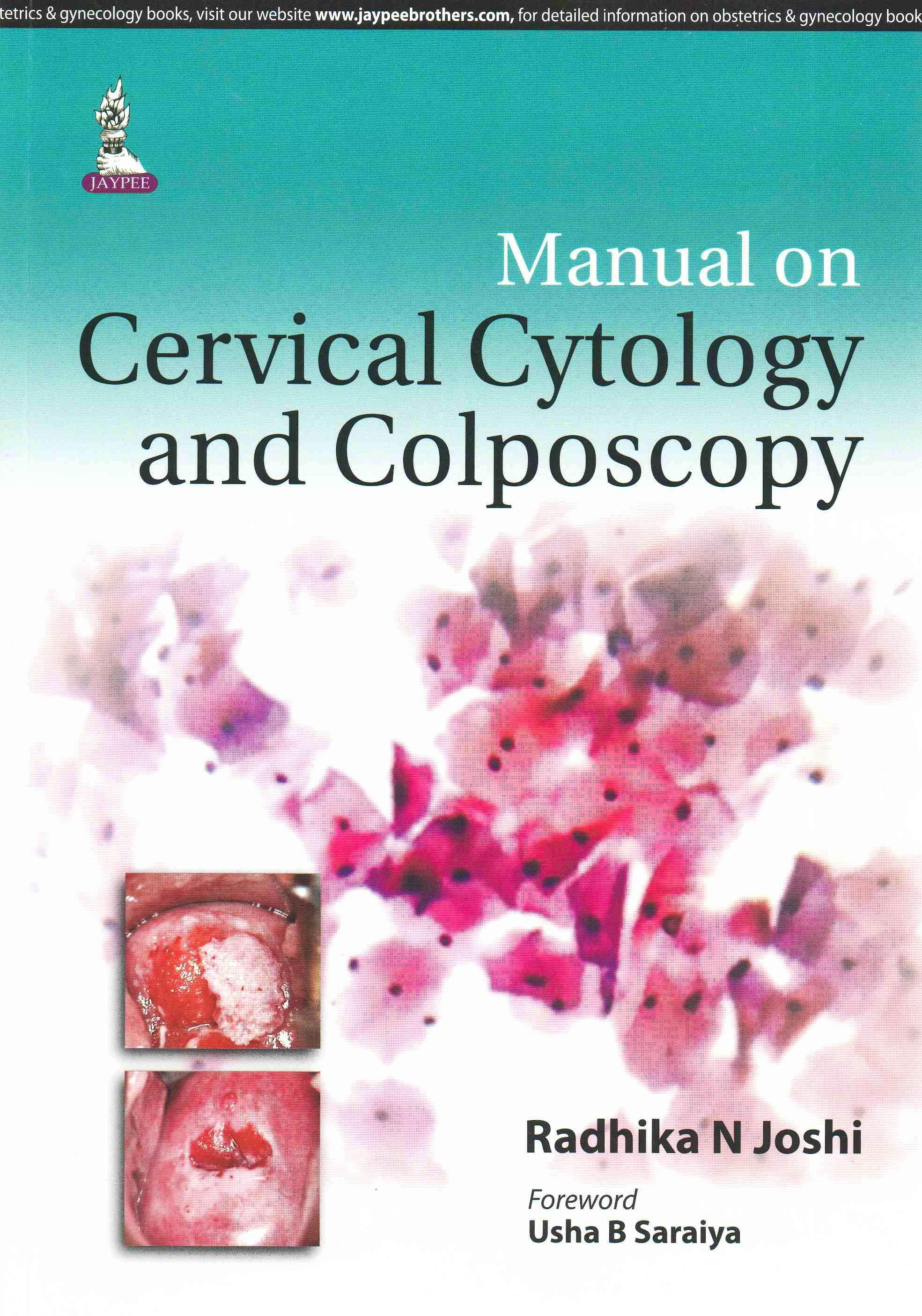 Portada del libro 9789351527640 Manual on Cervical Cytology and Colposcopy
