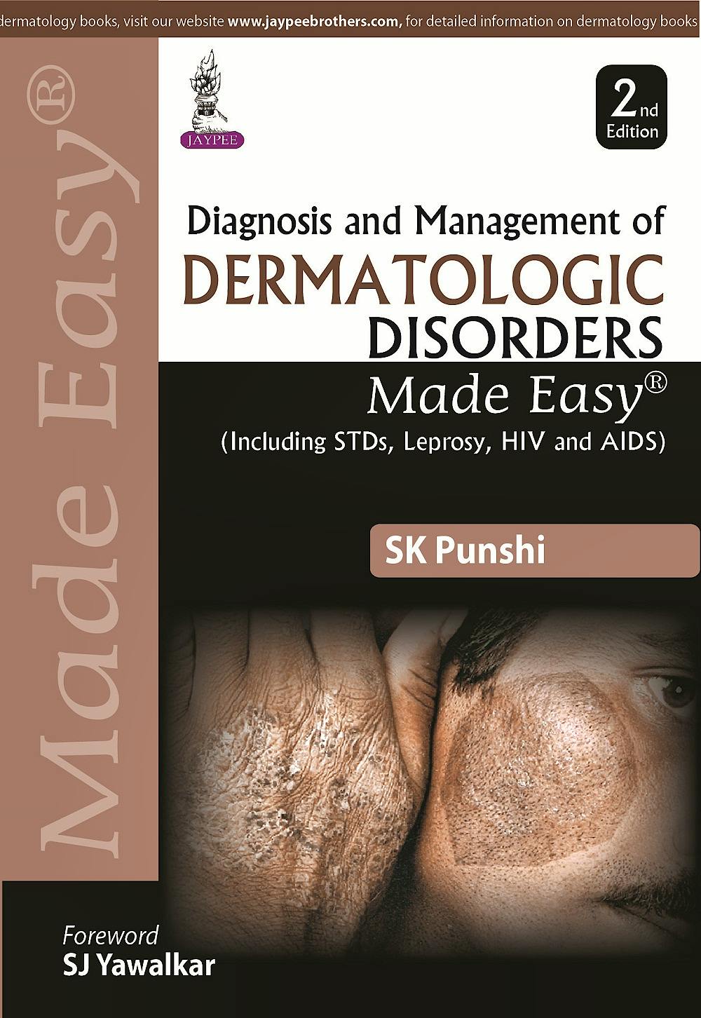 Portada del libro 9789351527930 Diagnosis and Management of Dermatologic Disorders Made Easy (Including Stds, Leprosy, Hiv and Aids)