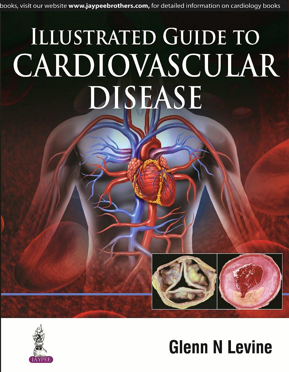 Portada del libro 9789351528449 Illustrated Guide to Cardiovascular Disease