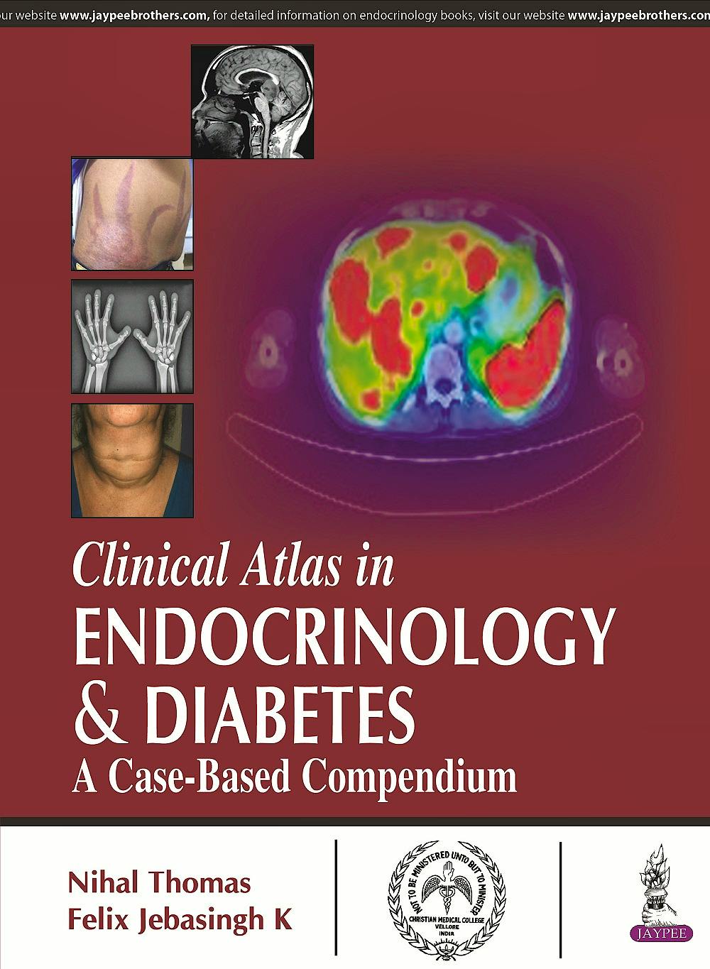 Portada del libro 9789351528579 Clinical Atlas in Endocrinology and Diabetes. A Case-Based Compendium