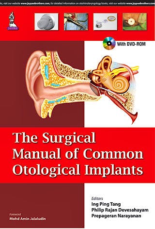 Portada del libro 9789351528586 The Surgical Manual of Common Otological Implants + Dvd