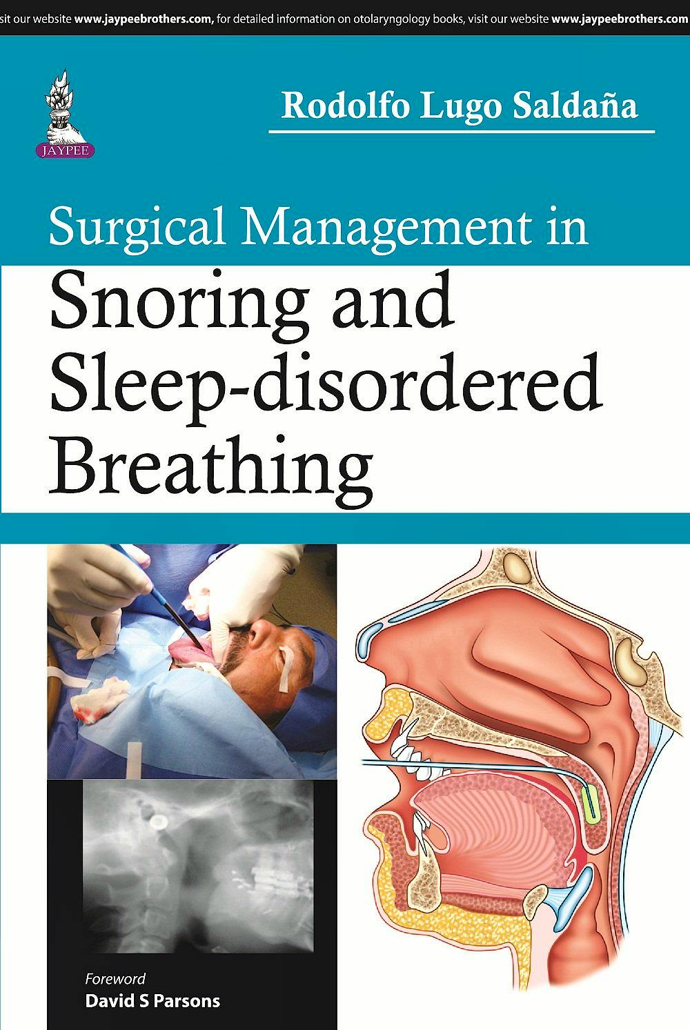 Portada del libro 9789351528890 Surgical Management in Snoring and Sleep-Disordered Breathing