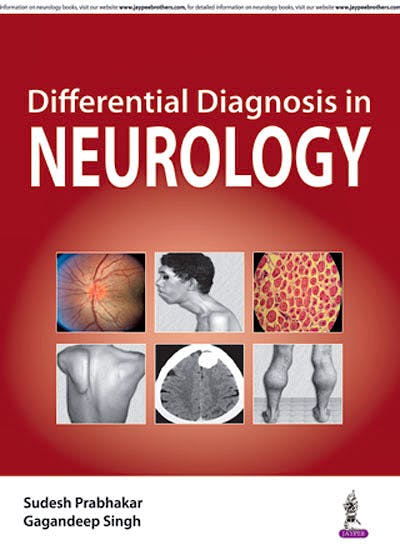 Portada del libro 9789351529026 Differential Diagnosis in Neurology