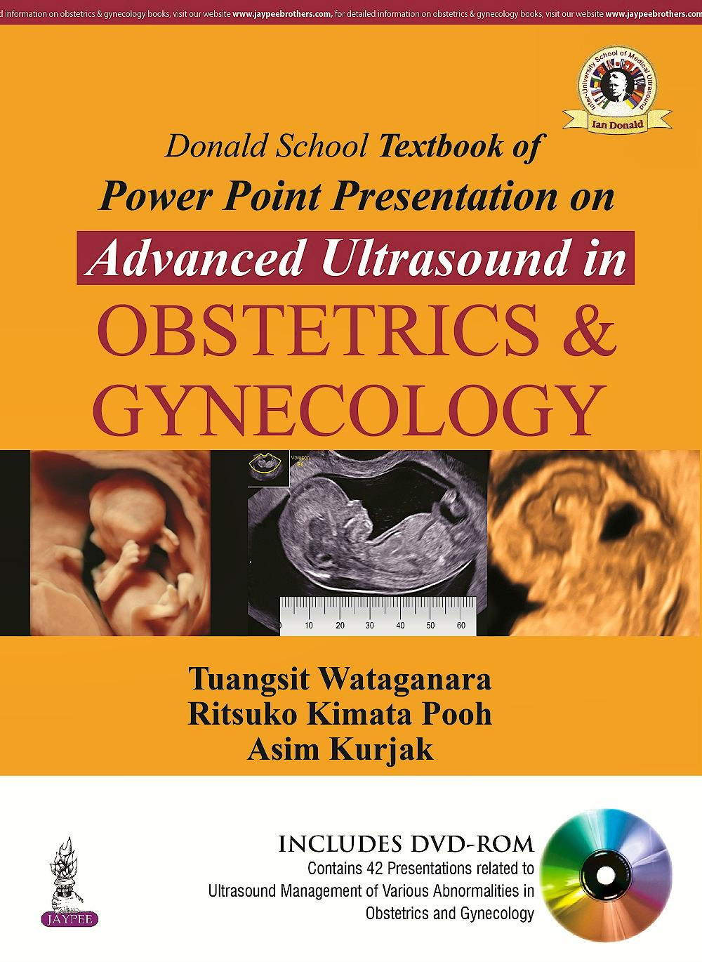 Portada del libro 9789351529200 Donald School Textbook of Powerpoint Presentation on Advanced Ultrasound in Obstetrics and Gynecology + Dvd