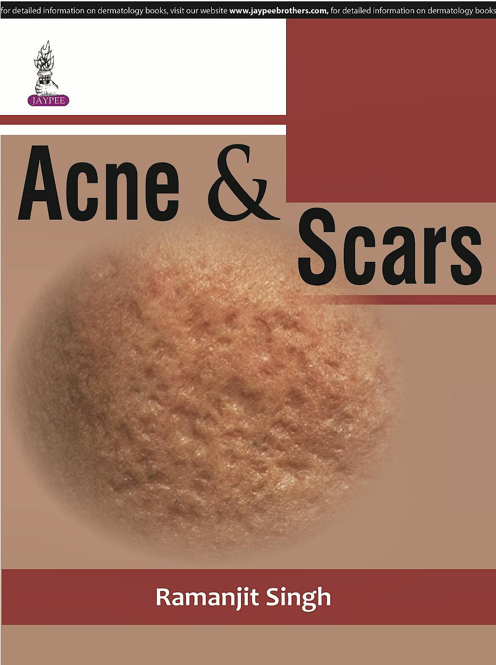 Portada del libro 9789351529699 Acne and Scars
