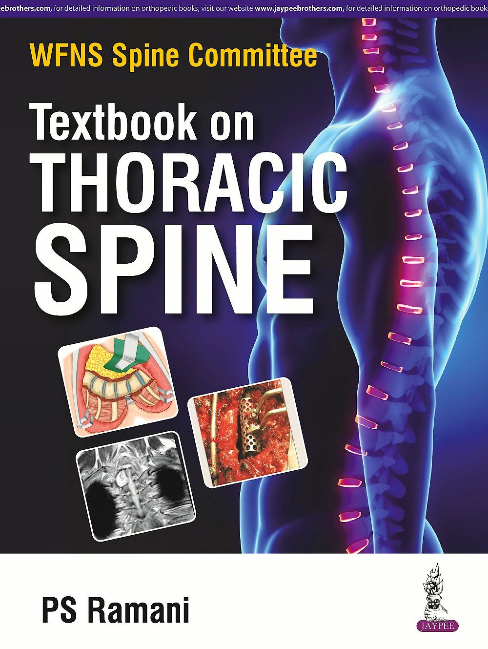 Portada del libro 9789352500079 WFNS Spine Committee Textbook on Thoracic Spine