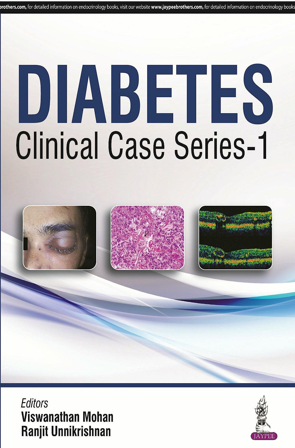 Portada del libro 9789352500321 Diabetes Clinical Case Series, Vol. 1