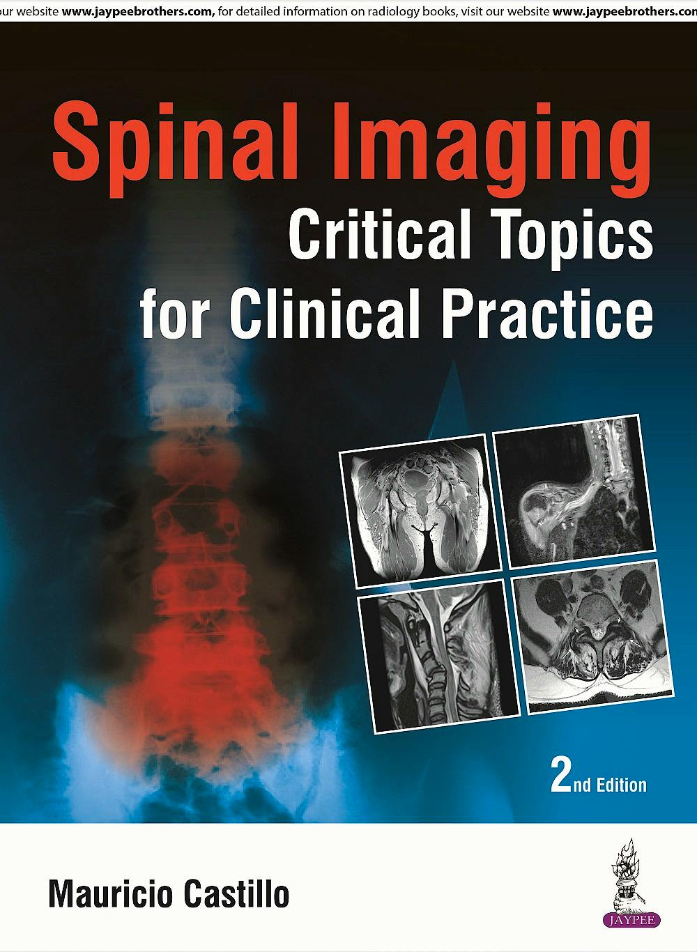 Portada del libro 9789352501250 Spinal Imaging: Critical Topics for Clinical Practice