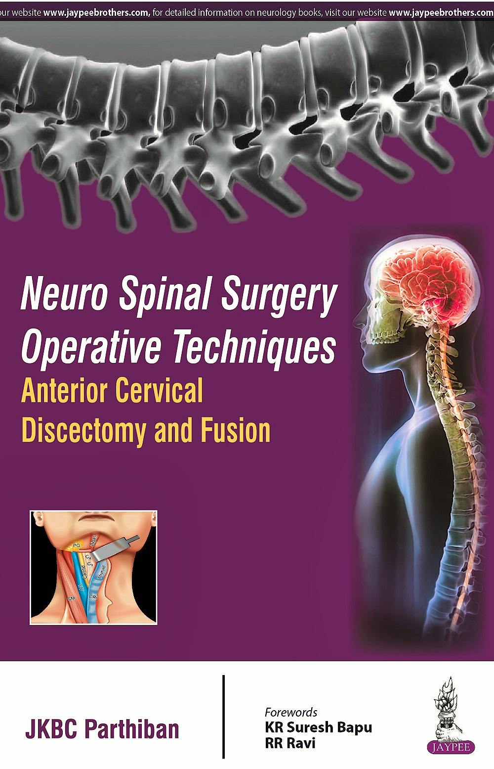Portada del libro 9789352501304 Neuro Spinal Surgery Operative Techniques. Anterior Cervical Discectomy and Fusion