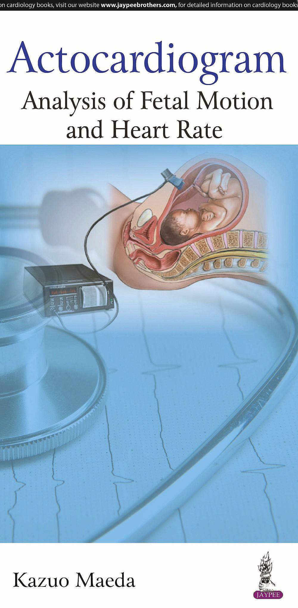 Portada del libro 9789352501861 Actocardiogram. Analysis of Fetal Motion and Heart Rate