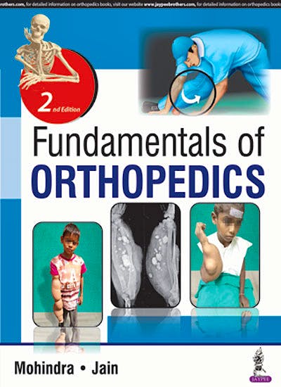 Portada del libro 9789352701322 Fundamentals of Orthopedics