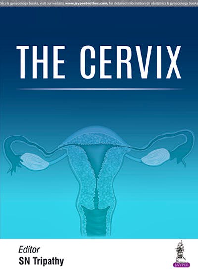 Portada del libro 9789352702091 The Cervix