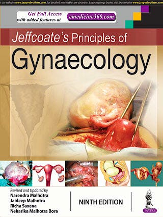 Portada del libro 9789352704774 Jeffcoate's Principles of Gynaecology