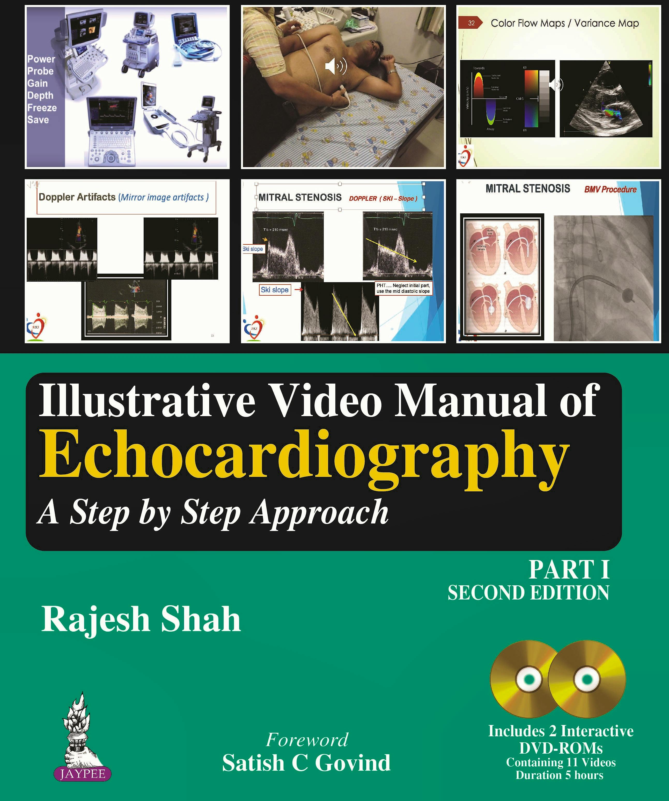 Portada del libro 9789352705047 Illustrative Video Manual of Echocardiography. A Step by Step Approach, Part 1 + 2 DVD-ROM