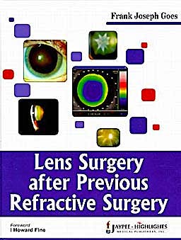 Portada del libro 9789380704647 Lens Surgery after Previous Refractive Surgery