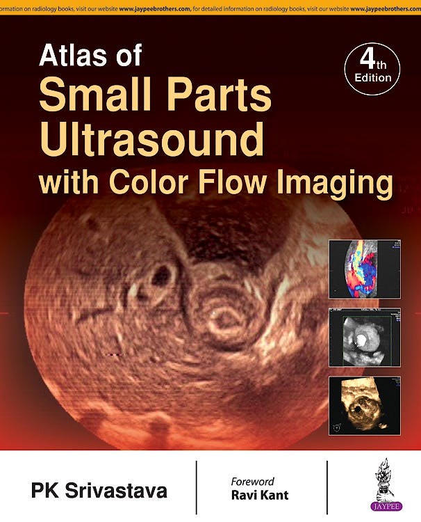 Portada del libro 9789386261991 Atlas of Small Parts Ultrasound with Color Flow Imaging