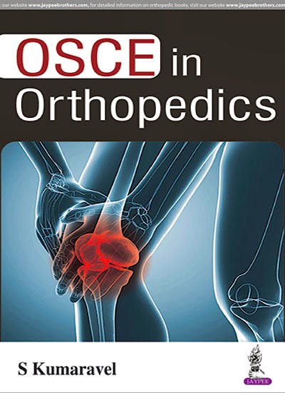 Portada del libro 9789386322135 Osce in Orthopedics