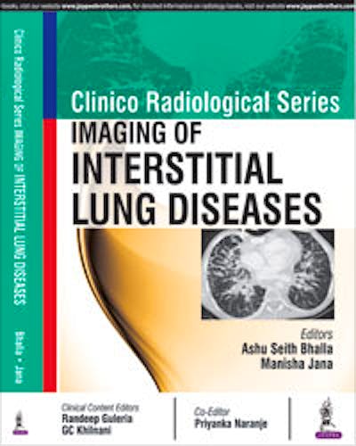 Portada del libro 9789386322517 Imaging of Interstitial Lung Diseases (Clinico Radiological Series)