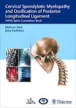 Portada del libro 9789390553204 Cervical Spondylotic Myelopathy and Ossification of Posterior Longitudinal Ligament. WFNS Spine Committee Book