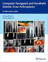 Portada del libro 9789390553402 Computer Navigated and Handheld Robotic Knee Arthroplasty. An Illustrative Guide