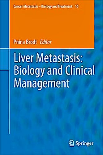 Portada del libro 9789400702912 Liver Metastasis: Biology and Clinical Management (Cancer Metastasis - Biology and Treatment, Vol. 16)