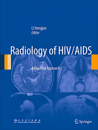 Portada del libro 9789400778221 Radiology of Hiv/aids. a Practical Approach