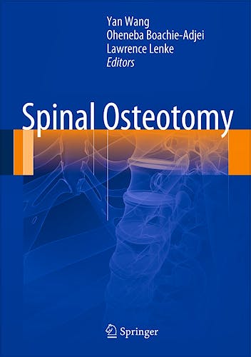 Portada del libro 9789401780377 Spinal Osteotomy (Hardcover)