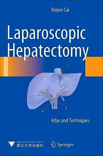 Portada del libro 9789401798396 Laparoscopic Hepatectomy. Atlas and Technique