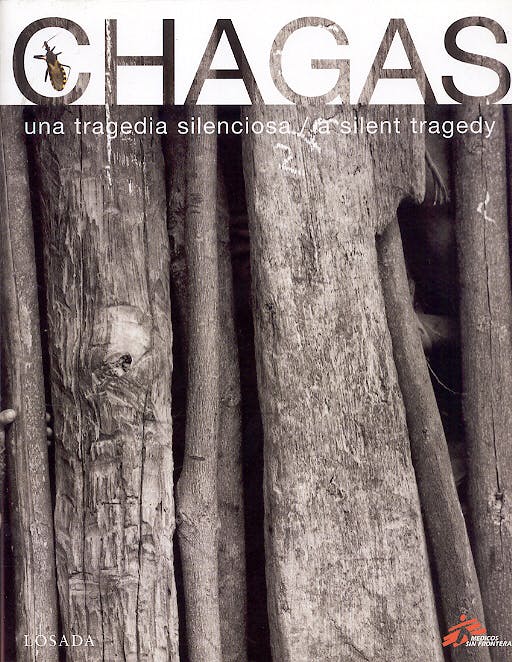 Portada del libro 9789500393690 Chagas. una Tragedia Sileciosa/ a Silent Tragedy