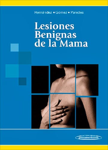 Portada del libro 9789500600002 Lesiones Benignas de la Mama