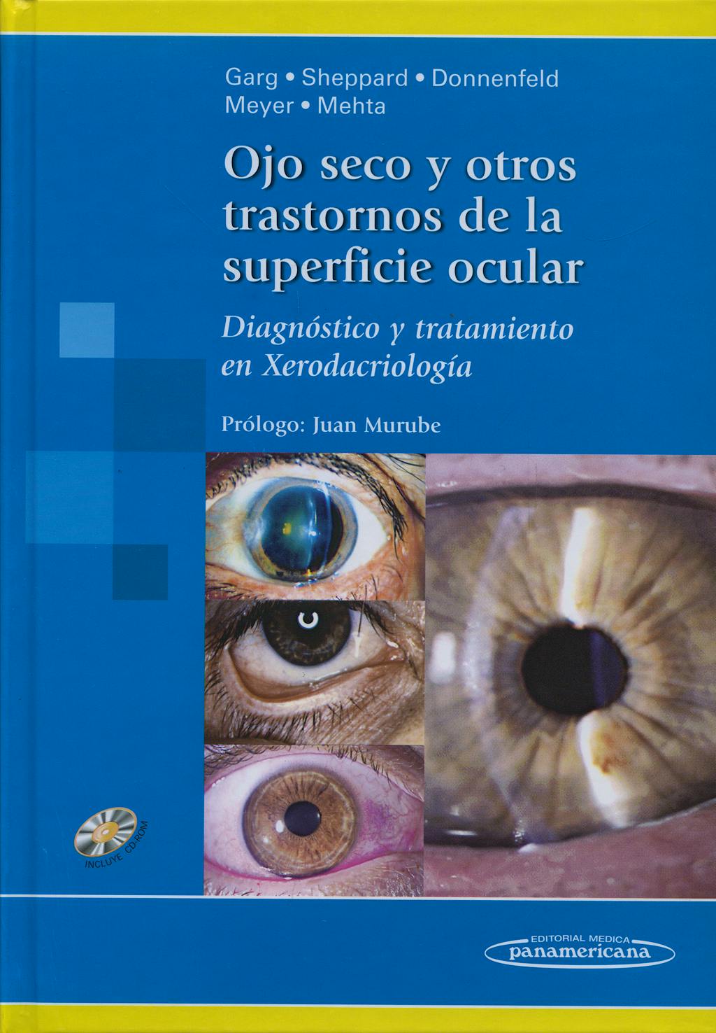 Portada del libro 9789500600880 Ojo Seco y Otros Trastornos de la Superficie Ocular. Diagnóstico y Tratamiento en Xerodacriología + CD