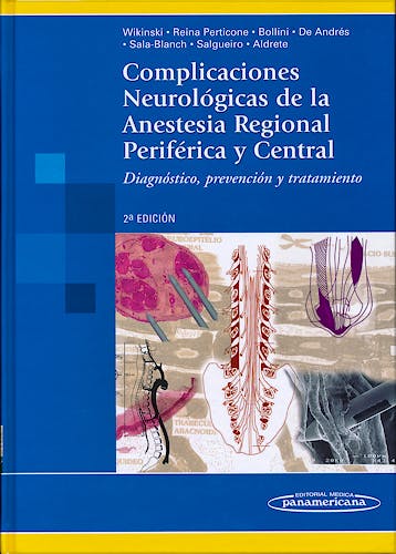 Portada del libro 9789500601306 Complicaciones Neurológicas de la Anestesia Regional Periférica y Central. Diagnóstico, Prevención y Tratamiento
