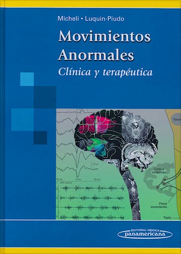 Portada del libro 9789500601337 Movimientos Anormales. Clínica y Terapéutica