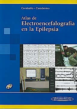 Portada del libro 9789500602600 Atlas de Electroencefalografía en la Epilepsia + DVD-ROM