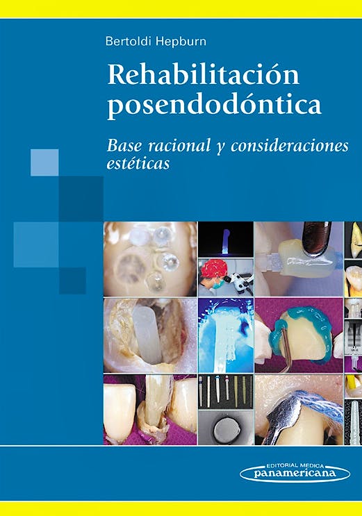 Portada del libro 9789500602655 Rehabilitacion Posendodontica. Base Racional y Consideraciones Esteticas