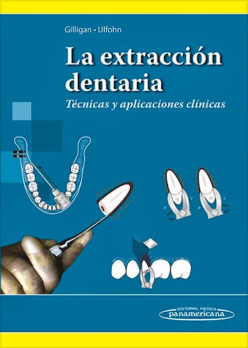 Portada del libro 9789500603140 La Extracción Dentaria. Técnicas y Aplicaciones Clínicas