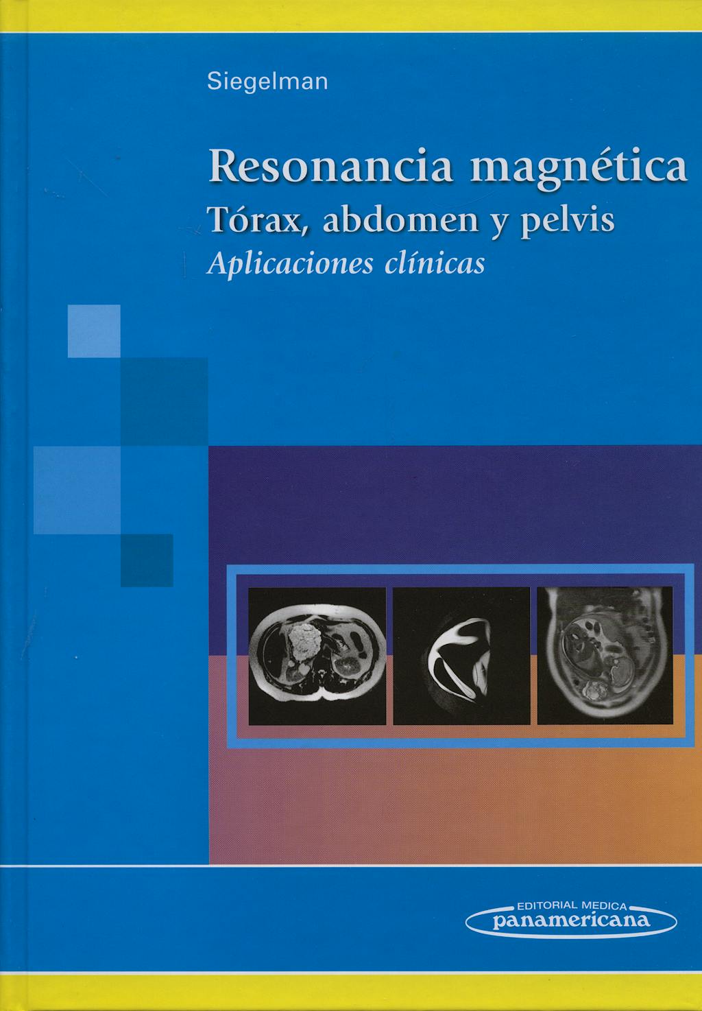 Portada del libro 9789500604451 Resonancia Magnética. Tórax, Abdomen y Pelvis. Aplicaciones Clínicas