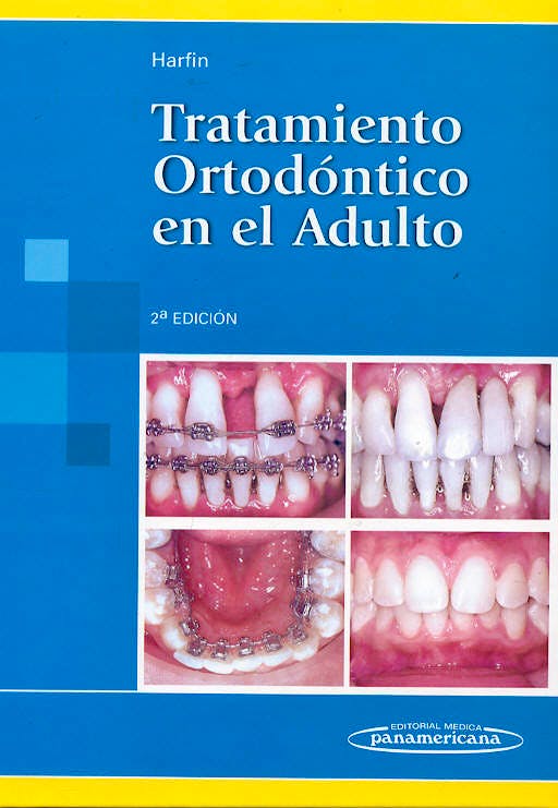 Portada del libro 9789500609296 Tratamiento Ortodontico en el Adulto