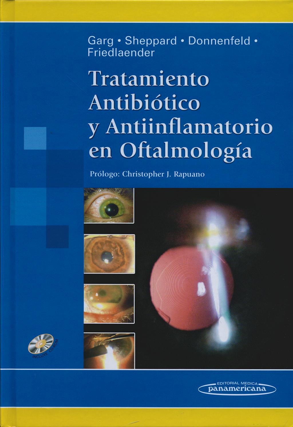 Portada del libro 9789500617123 Tratamiento Antibiótico y Antiinflamatorio en Oftalmología + CD-ROM