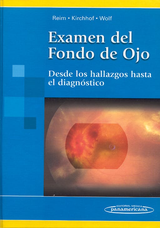 Portada del libro 9789500618083 Examen del Fondo de Ojo. desde los Hallazgos hasta el Diagnostico