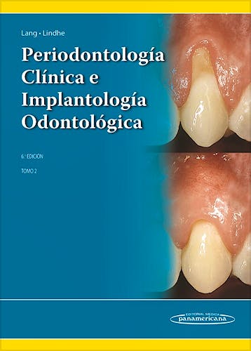 Portada del libro 9789500694940 Periodontología Clínica e Implantología Odontológica, Tomo 2