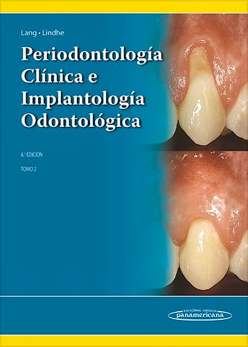 Portada del libro 9789500694940 Periodontología Clínica e Implantología Odontológica, Tomo 2