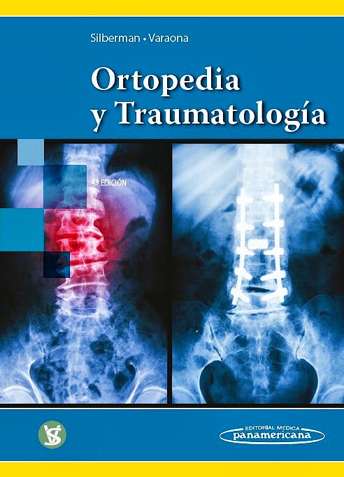 Ortopedia Y Traumatología