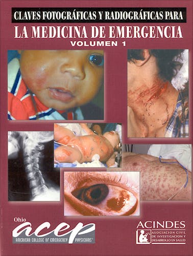 Portada del libro 9789507622816 Claves Fotográficas y Radiográficas para la Medicina de Emergencia, Vol. 1