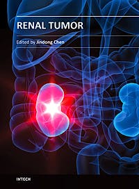 Portada del libro 9789535109815 Renal Tumor