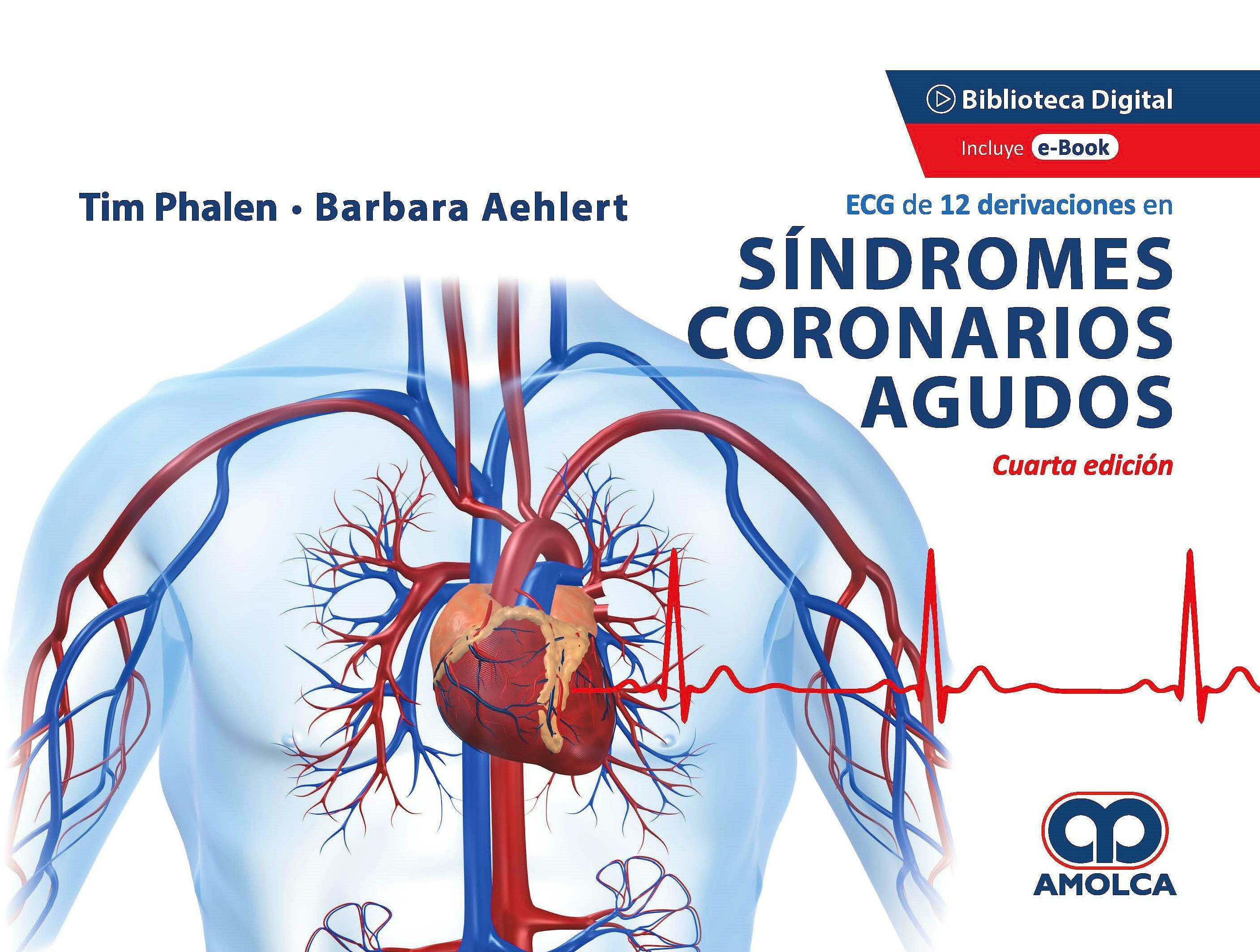 ECG De 12 Derivaciones En Síndromes Coronarios Agudos: 9789585303546 ...