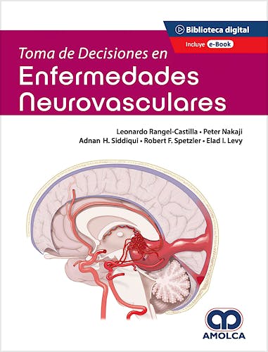 Portada del libro 9789585303607 Toma de Decisiones en Enfermedades Neurovasculares