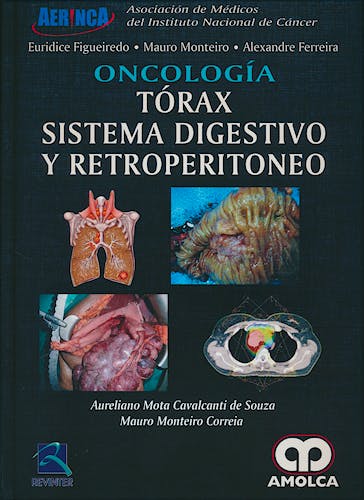 Portada del libro 9789585426047 Oncología. Tórax, Sistema Digestivo y Retroperitoneo