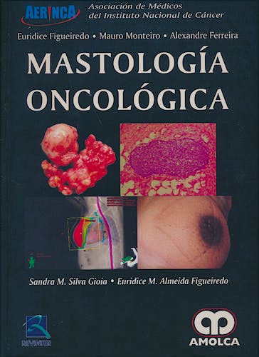 Portada del libro 9789585426054 Mastología Oncológica