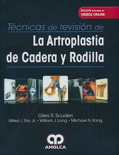 Portada del libro 9789585426092 Técnicas de Revisión de la Artroplastia de Cadera y Rodilla + Videos Online